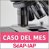 #CasodelMes Enero 2026