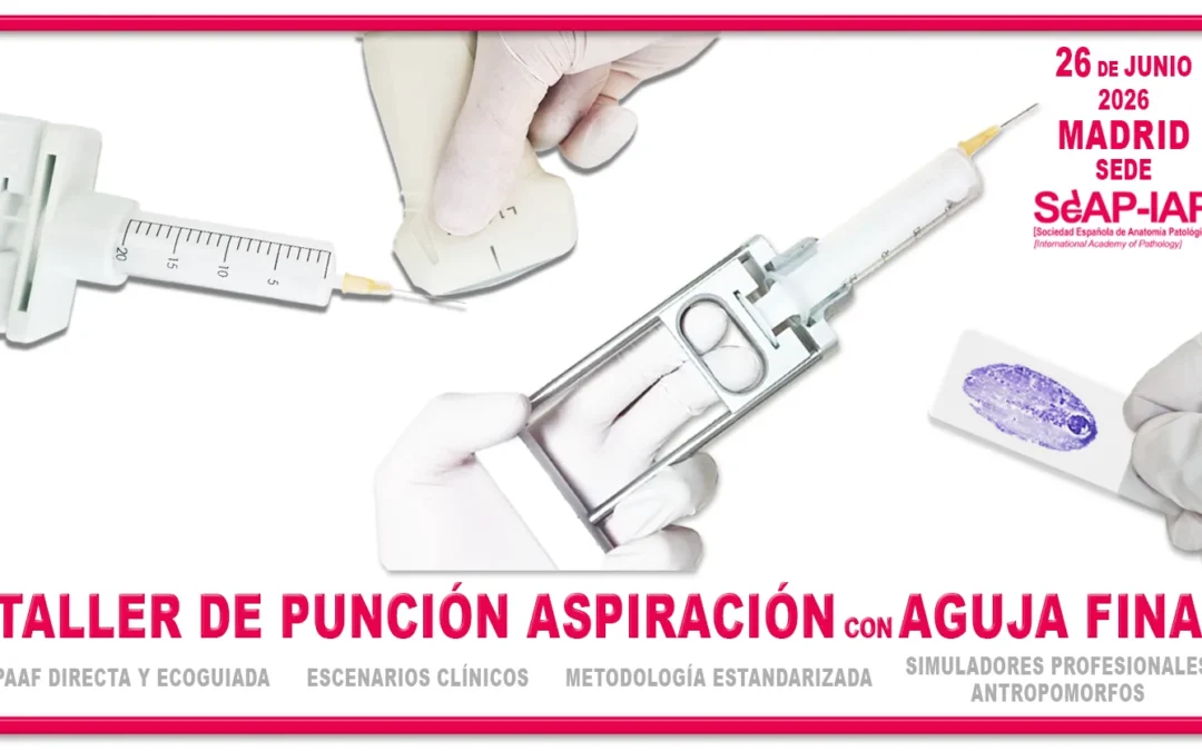 Taller de Punción Aspiración con aguja fina. 26 de junio 2026. Plazas limitadas, inscripción previa