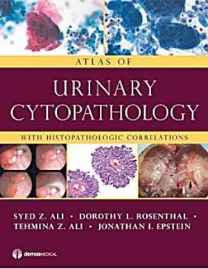 Atlas Of Urinary Cytopathology With Histopathologic Correlations