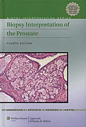 Biopsy Interpretation of The Prostate