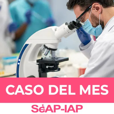 #CasodelMes Enero 2026