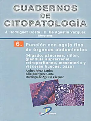 Cuadernos de Citopatología – 6 – Punción con aguja fina de órganos abdominales