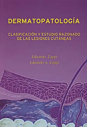 Dermatopatología: Clasificación y estudio razonado de las lesiones cutáneas