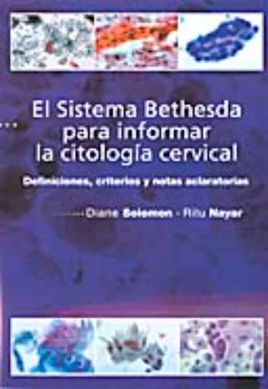 El Sistema Bethesda para informar la citología cervical