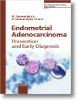 Endometrial Adenocarcinoma