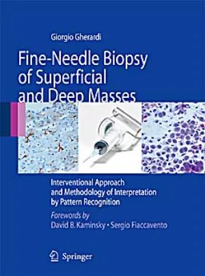 Fine-needle biopsy of superficial and deep masses