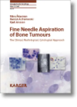 Fine Needle Aspiration of Bone Tumours. The Clinical, Radiological, Cytological Approach