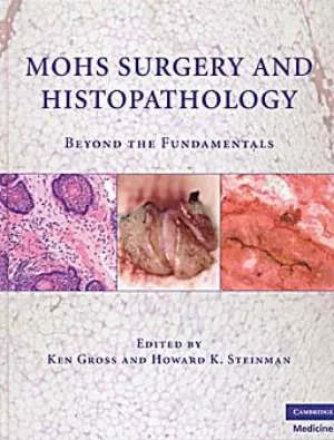 Mohs surgery and histopathology. Beyond the fundamentals