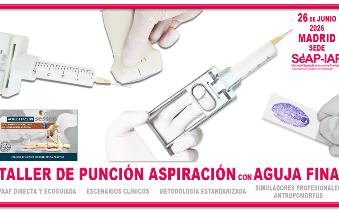 Taller de Punción Aspiración con aguja fina. 26 de junio 2026. Plazas limitadas, inscripción previa