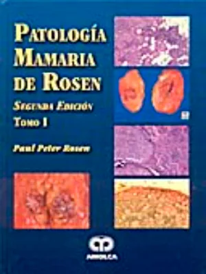 Patología mamaria