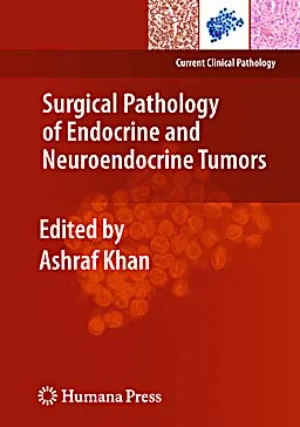 Surgical Pathology Of Endocrine And Neuroendocrine Tumors