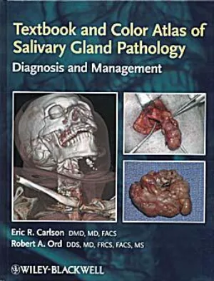 Textbook and color atlas of salivary gland pathology. Diagnosis & management