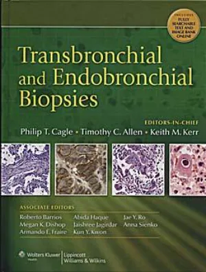 Transbronchial and Endobronchial Biopsies