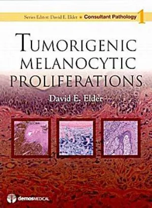 Tumorigenic melanocytic proliferations. Consultant pathology series