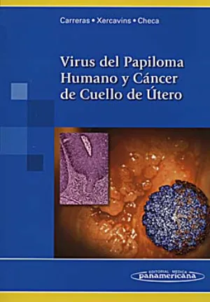 Virus del Papiloma Humano y Cáncer de Cuello de Útero