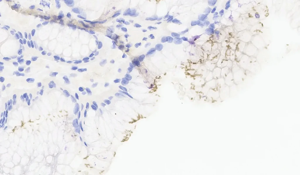 4. Helicobater pylori IHQ